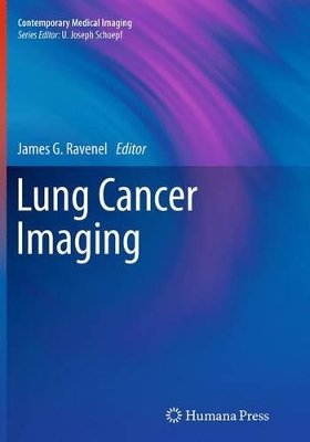 Lung Cancer Imaging book
