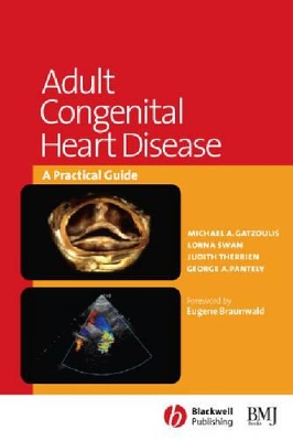 Adult Congenital Heart Disease: A Practical Guide book