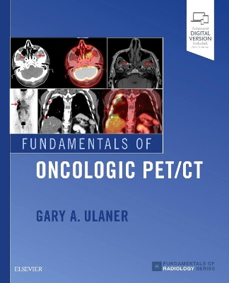 Fundamentals of Oncologic PET/CT book