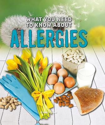 What You Need to Know about Allergies by Nancy Dickmann