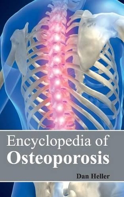 Encyclopedia of Osteoporosis by Dan Heller