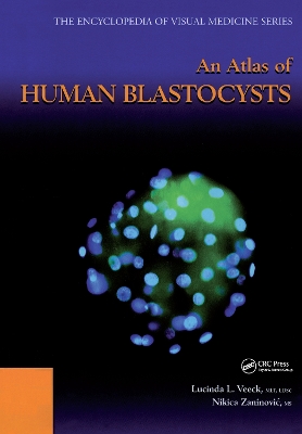 Atlas of Human Blastocysts book