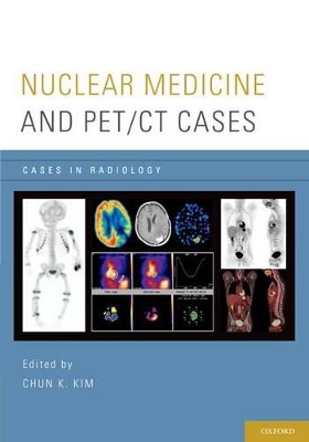 Nuclear Medicine and PET/CT Cases book