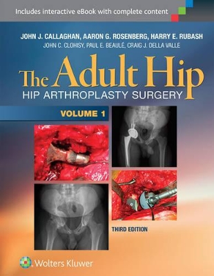 The Adult Hip (Two Volume Set): Hip Arthroplasty Surgery book