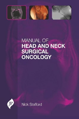 Manual of Head and Neck Surgical Oncology book