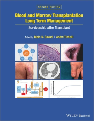 Blood and Marrow Transplantation Long Term Management: Survivorship after Transplant book