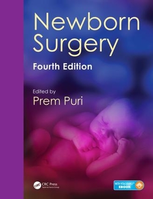 Newborn Surgery book