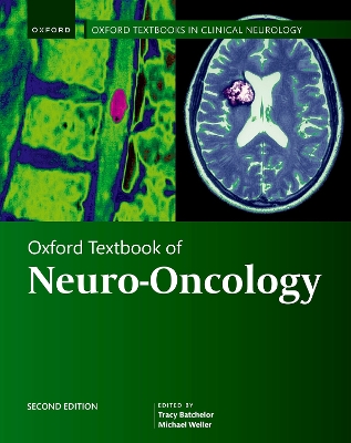 Oxford Textbook of Neuro-Oncology book