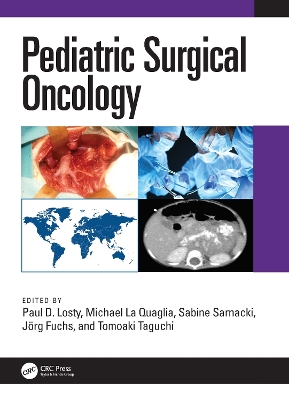 Pediatric Surgical Oncology book