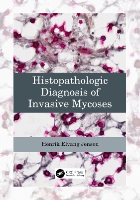 Histopathologic Diagnosis of Invasive Mycoses by Henrik Elvang Jensen