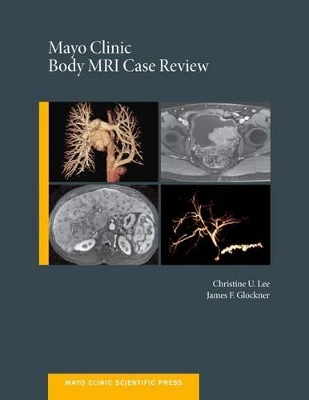 Mayo Clinic Body MRI Case Review book