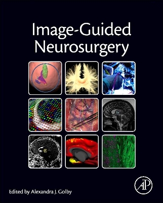 Image-Guided Neurosurgery book