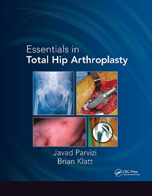 Essentials in Total Hip Arthroplasty book