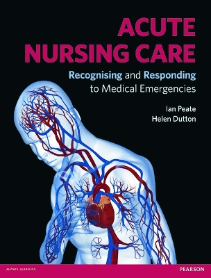 Acute Nursing Care by Helen Dutton