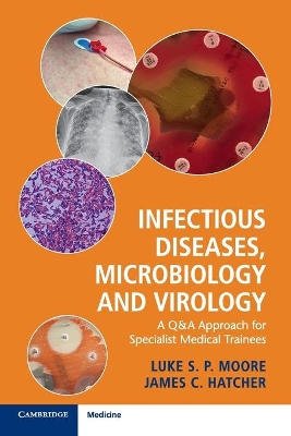 Infectious Diseases, Microbiology and Virology: A Q&A Approach for Specialist Medical Trainees book