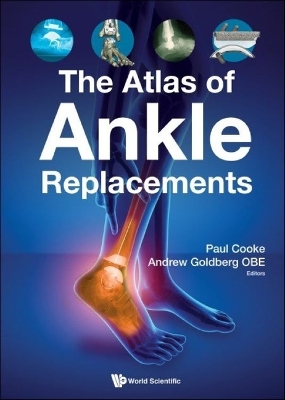 The Atlas of Ankle Replacements book