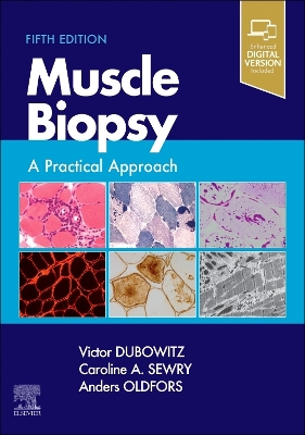 Muscle Biopsy: A Practical Approach book