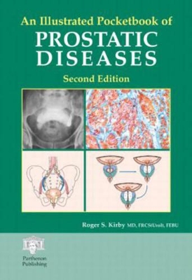 Illustrated Pocketbook of Prostatic Disease book