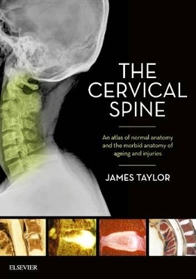 Cervical Spine book