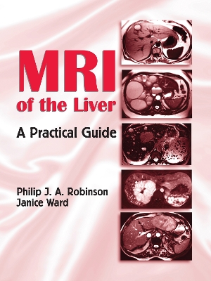 MRI of the Liver by Philip J. A. Robinson