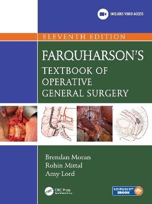 Farquharson's Textbook of Operative General Surgery by Brendan Moran
