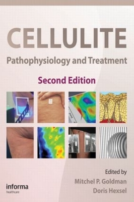 Cellulite book