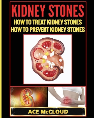 Kidney Stones book