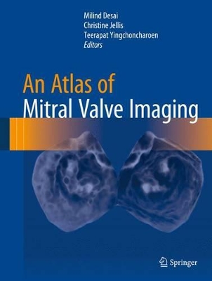 An Atlas of Mitral Valve Imaging book