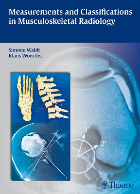 Measurements and Classifications in Musculoskeletal Radiology book