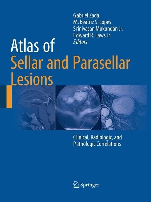 Atlas of Sellar and Parasellar Lesions book