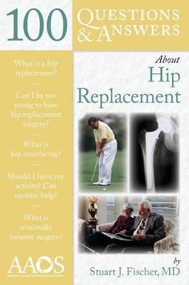 100 Questions & Answers About Hip Replacement book