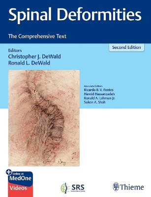 Spinal Deformities: The Comprehensive Text by Ronald Dewald