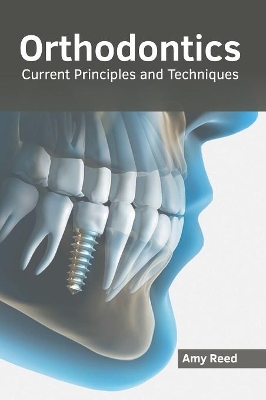 Orthodontics: Current Principles and Techniques book