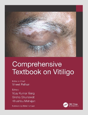 Comprehensive Textbook on Vitiligo by Vineet Relhan