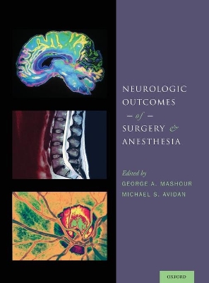 Neurologic Outcomes of Surgery and Anesthesia book