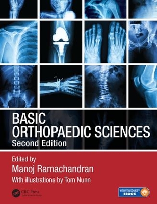 Basic Orthopaedic Sciences, Second Edition book