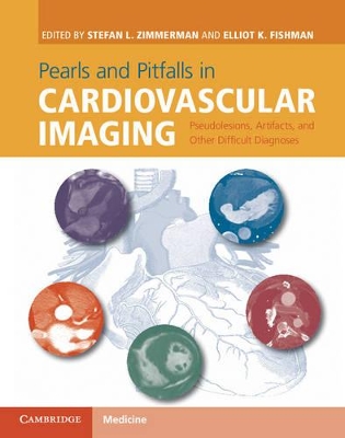 Pearls and Pitfalls in Cardiovascular Imaging book