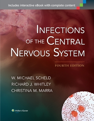 Infections of the Central Nervous System book