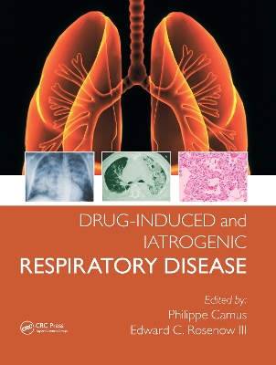 Drug-induced and Iatrogenic Respiratory Disease by Phillipe Camus