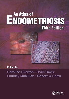 Atlas of Endometriosis, Third Edition book