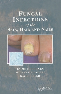 Fungal Infections of the Skin and Nails by Raimo E. Suhonen