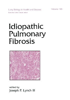 Idiopathic Pulmonary Fibrosis book