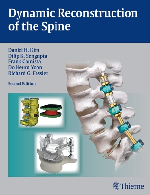 Dynamic Reconstruction of the Spine book