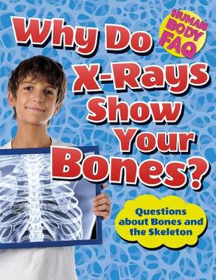 Why Do X-Rays Show Your Bones? by Thomas Canavan