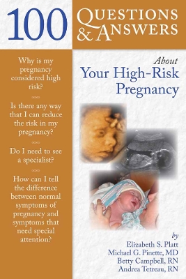 100 Questions & Answers About Your High-Risk Pregnancy book