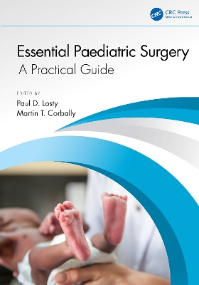 Essential Paediatric Surgery: A Practical Guide book