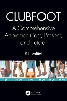 Clubfoot: A Comprehensive Approach (Past, Present, and Future) by R. L. Mittal