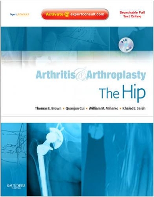 Arthritis and Arthroplasty: The Hip book