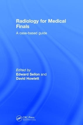 Radiology for Medical Finals by Edward Sellon