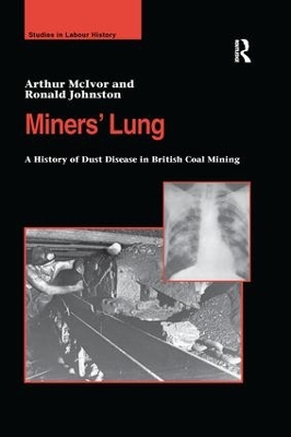Miners' Lung: A History of Dust Disease in British Coal Mining by Arthur McIvor